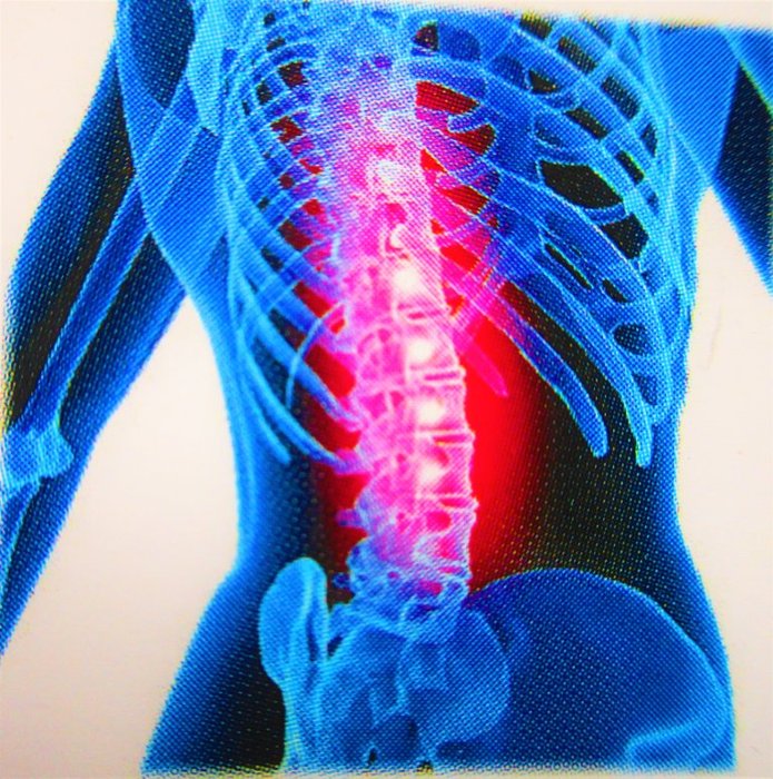 Workshops Aplomb - zorgzaam omgaan je rug