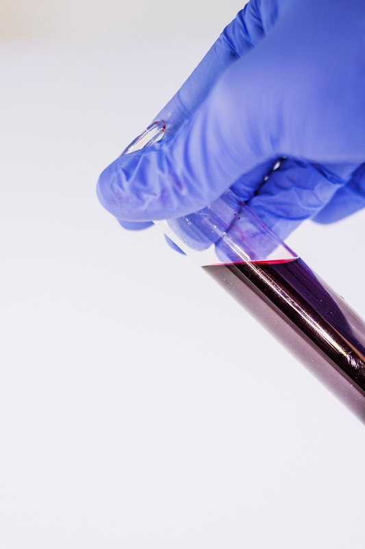 Voordrachten  Liquid biopsies : vloeibare venster tumoren